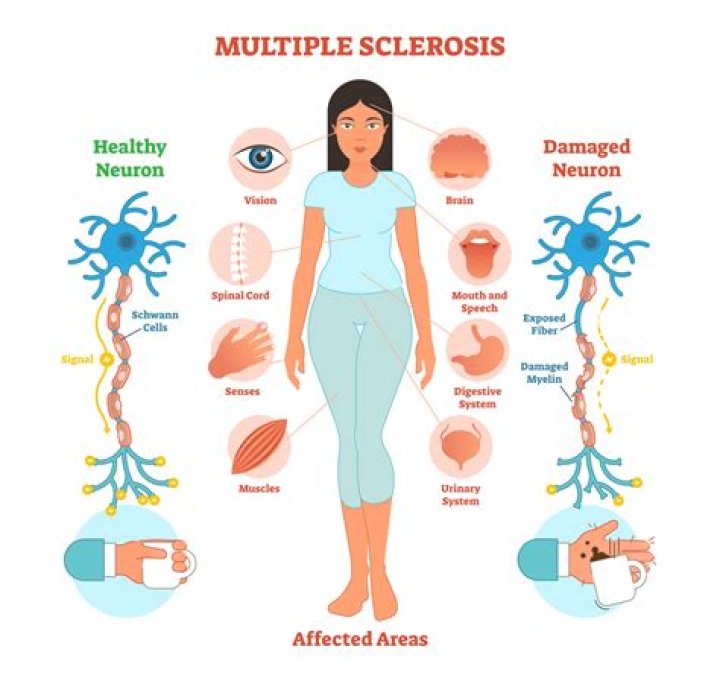 Can MS affect impulse control?